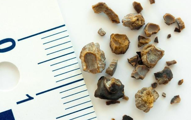 问鼎pg官网入口